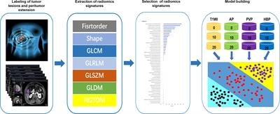 Preoperative Prediction of Microvascular Invasion Risk Grades in Hepatocellular Carcinoma Based on Tumor and Peritumor Dual-Region Radiomics Signatures